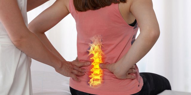 HERNIA NUKLEUS PULPOSUS (HNP) LUMBAL atau SARAF KEJEPIT DI PINGGANG