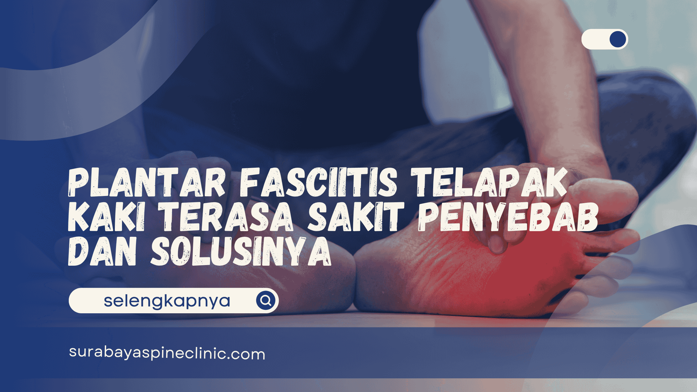  Plantar Fasciitis Telapak Kaki Terasa Sakit Penyebab dan Solusinya