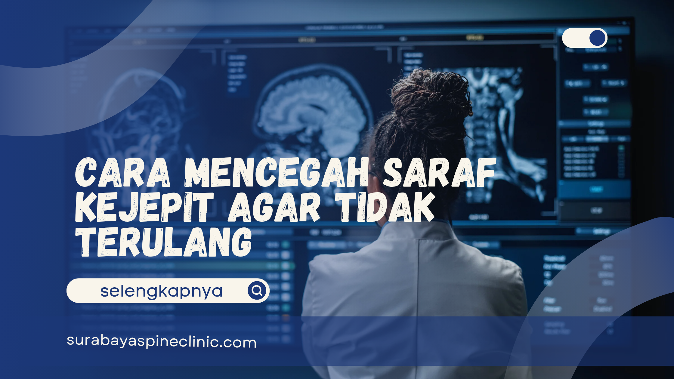  Cara Mencegah Saraf Kejepit Agar Tidak Terulang