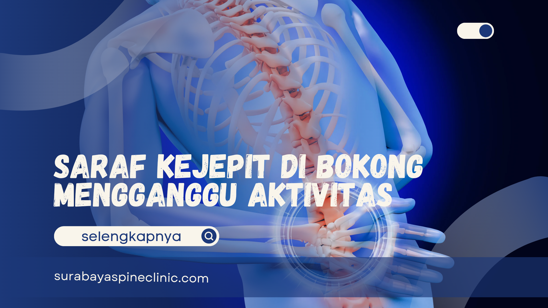  Saraf Kejepit di Bokong Mengganggu Aktivitas