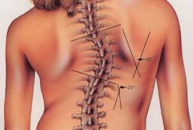 Surabaya Spine Clinic